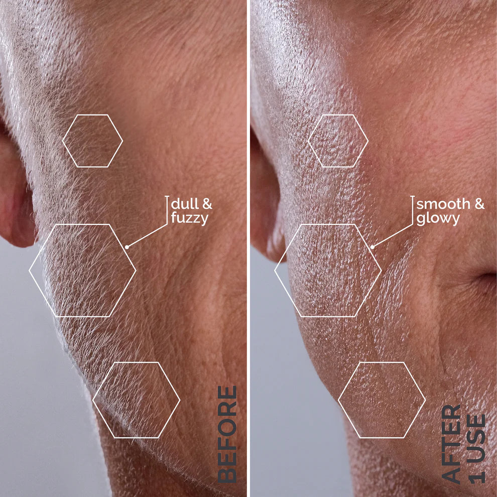 SmoothLift™ by Slimologi