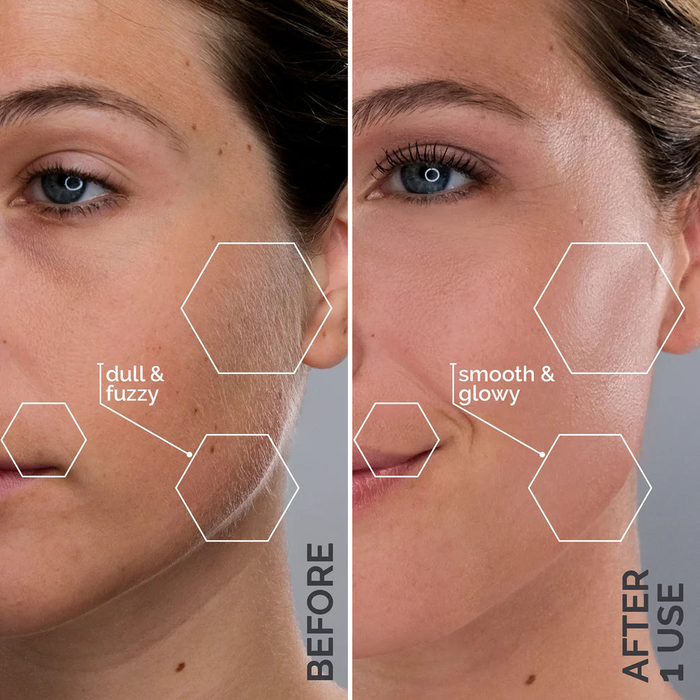 SmoothLift™ by Slimologi